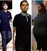 Image result for Anant Ambani Before and After