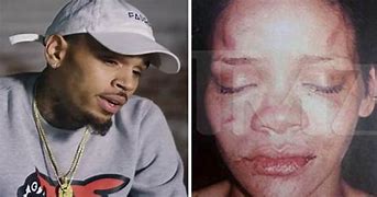 Image result for Rihanna Beaten Chris Brown