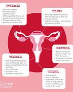 Image result for Specialist London Ovarian Cancer