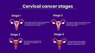 Image result for Cervical Cancer Warning Sign