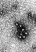 Image result for Parvovirus B19 Electron Microscope