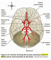 Image result for Circle of Willis in a Patient Standing Up