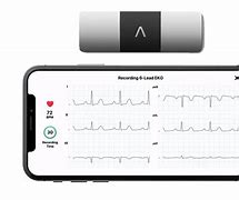 Image result for Cardiac ECG Smartwatch