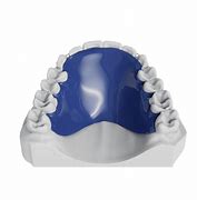 Image result for C Clasp Ortho
