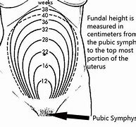 Image result for Fundal Height Cm