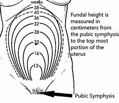 Image result for Fundal Height
