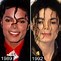 Image result for Michael Jackson without Prosthetic Nose