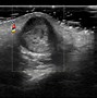 Image result for 9 Weeks Pregnant Ultrasound Twins