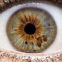Image result for Grey Ring Outside Iris