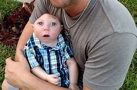 Image result for Oldest Person with Anencephaly