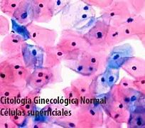 Image result for citodiagnosis