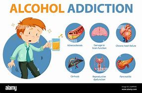 Image result for akcohol�metro