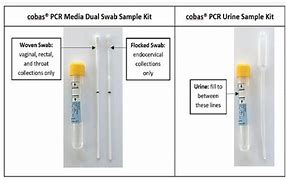 Image result for Chlamydia Trachomatis Test Kit