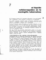 Image result for cefalorraqu�xeo