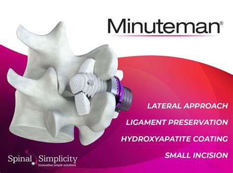 Image result for What Is Spinal Simplicity