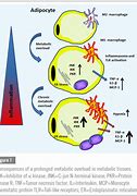 Image result for Obesity Inflammation