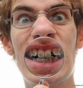 Image result for A Kid with Glasses and Braces
