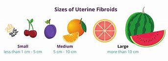 Image result for Uterine Fibroid Uterus Size Chart