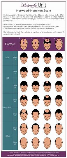 Men S Best Guide To Going Bald Shaving Head Amp Hair Loss
