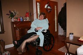 Image result for Broken Leg Cast Wheelchair