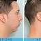 Image result for Building Jaw Muscles