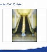 Image result for 20 200 Vision
