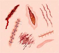 Image result for Cartoon Stitches Scar
