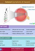 Image result for Vision Loss