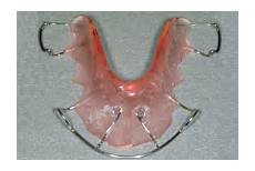 apparecchio mobile apparecchio dentale ortodonzia dott marco dormi apparecchio mobile apparecchio dentale ortodonzia dott marco dormi