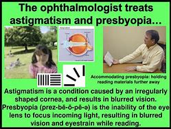Image result for Myopia and Hyperopia