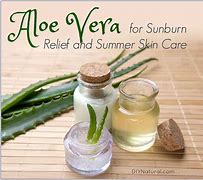 Image result for Aloe Vera for Sunburn