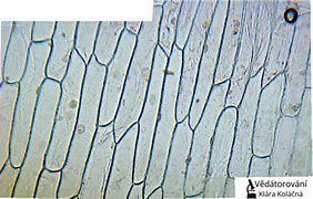 Image result for Cibule Pod Mikroskopem