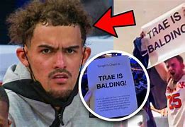 Image result for Trae Young Bald Spot