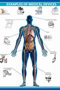 Image result for Biomedical Devices Examples