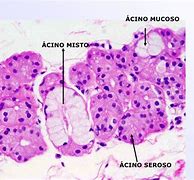 Image result for acinoso