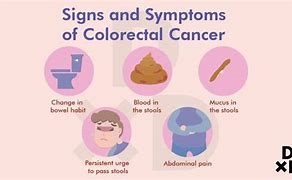 Image result for Bowel Cancer Women