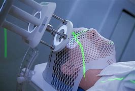 Image result for Therapeutic Radiography