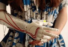 Image result for Prosthetic Robot Arm