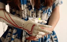 Image result for Robotic Prosthetic Arm