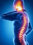 Image result for Spinal Cord Photo