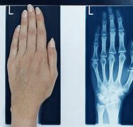 Image result for X-ray Vision