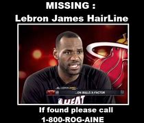 Image result for LeBron Hairline Meme