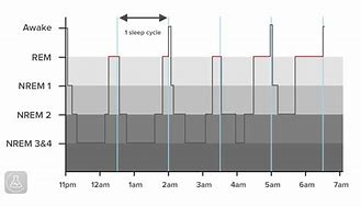 Image result for Different Types of REM Sleep