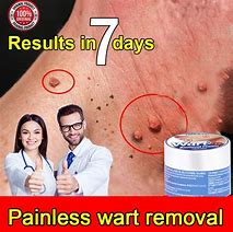 Image result for Molluscum Wart Remover