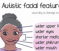 Image result for Autism Poker Face