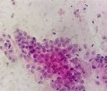 Image result for Trichomonas Vaginalis Under Microscope
