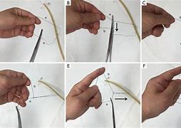 Image result for Suture Knot Tying Scissors