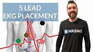 Image result for 5 Lead ECG Placement Philips Monitor