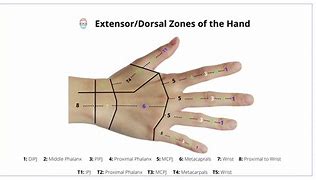 Image result for What Has Five Hands