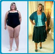 Image result for Best Weight Loss Before and After